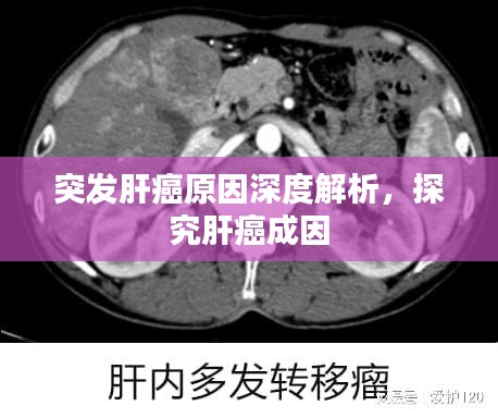 突發肝癌原因深度解析，探究肝癌成因
