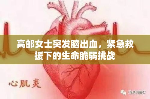 高郵女士突發(fā)腦出血，緊急救援下的生命脆弱挑戰(zhàn)